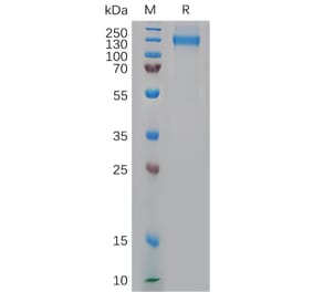 SDS-PAGE - Recombinant Rhesus macaque NCL Protein (6×His Tag) (A317554) - Antibodies.com