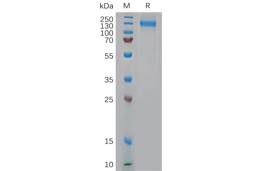 SDS-PAGE - Recombinant Rhesus macaque NCL Protein (6×His Tag) (A317554) - Antibodies.com