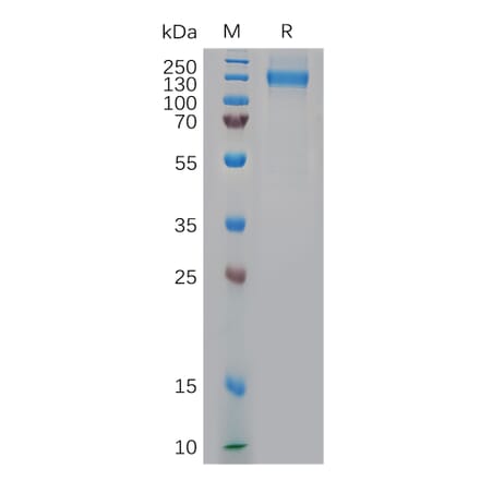 SDS-PAGE - Recombinant Rhesus macaque NCL Protein (6×His Tag) (A317554) - Antibodies.com