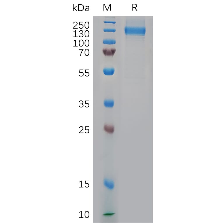 SDS-PAGE - Recombinant Rhesus macaque NCL Protein (6×His Tag) (A317554) - Antibodies.com