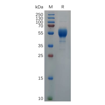 SDS-PAGE - Recombinant Cynomolgus macaque IL-9 Protein (Fc Tag) (A317555) - Antibodies.com