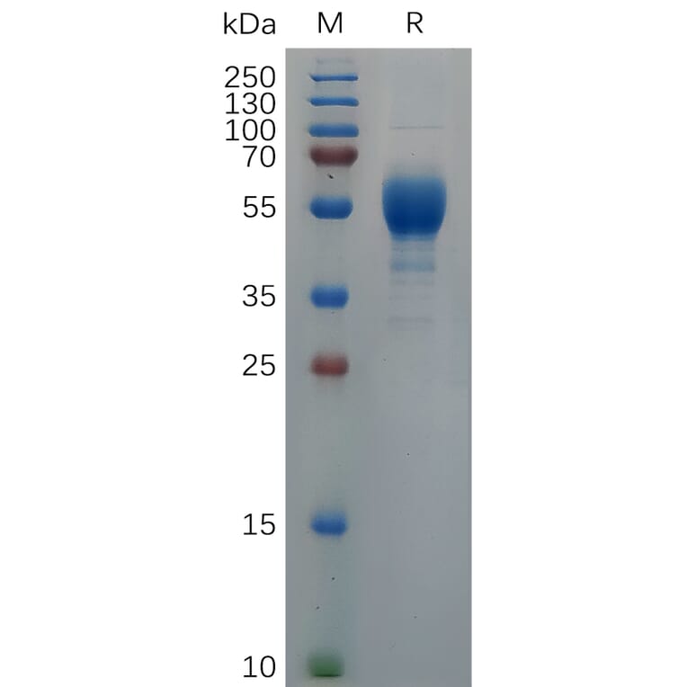 SDS-PAGE - Recombinant Cynomolgus macaque IL-9 Protein (Fc Tag) (A317555) - Antibodies.com