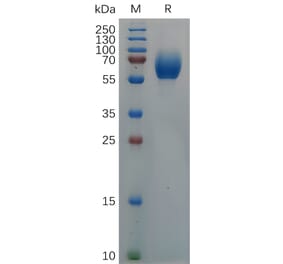 SDS-PAGE - Recombinant Cynomolgus macaque IL18BP Protein (Fc Tag) (A317557) - Antibodies.com