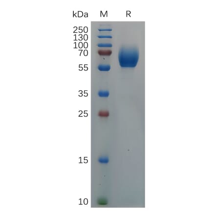 SDS-PAGE - Recombinant Cynomolgus macaque IL18BP Protein (Fc Tag) (A317557) - Antibodies.com
