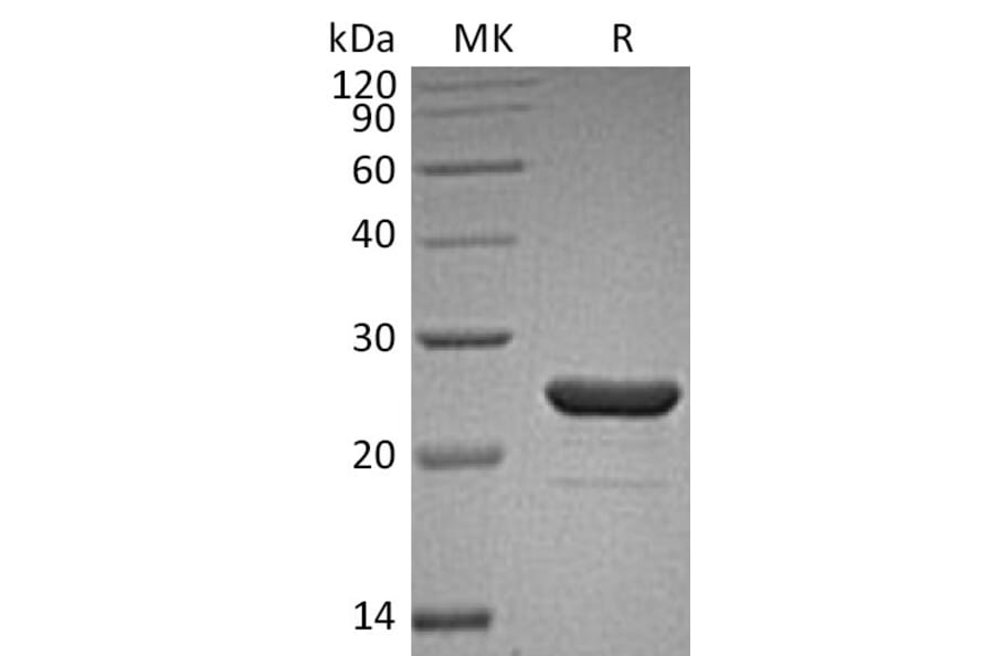 SDS-PAGE - Recombinant Human FGF9/GAF Protein (A317558) - Antibodies.com