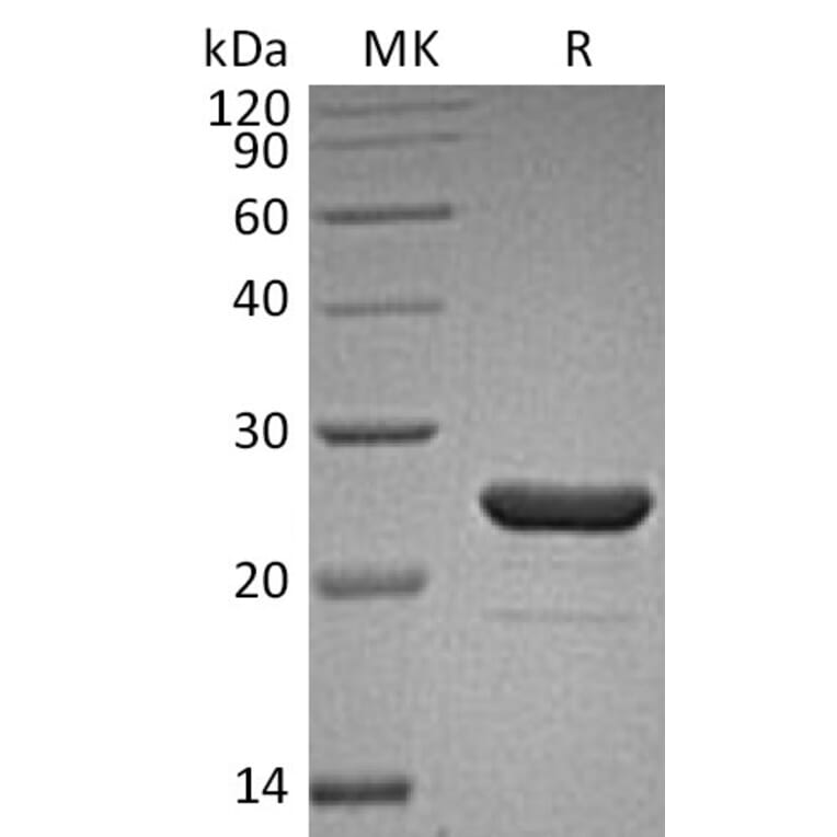 SDS-PAGE - Recombinant Human FGF9/GAF Protein (A317558) - Antibodies.com