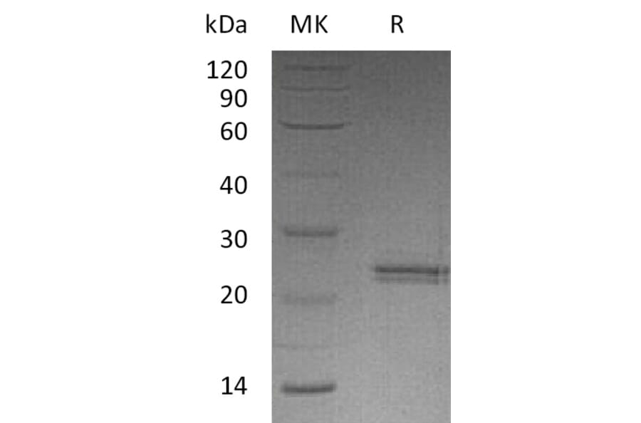 SDS-PAGE - Recombinant Human CNTF Protein (A317560) - Antibodies.com