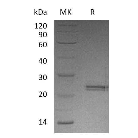 SDS-PAGE - Recombinant Human CNTF Protein (A317560) - Antibodies.com