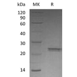 SDS-PAGE - Recombinant Human CNTF Protein (A317560) - Antibodies.com