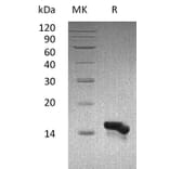 SDS-PAGE - Recombinant Human CCL28/MEC Protein (A317561) - Antibodies.com