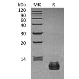 SDS-PAGE - Recombinant Human CCL27 Protein (A317563) - Antibodies.com