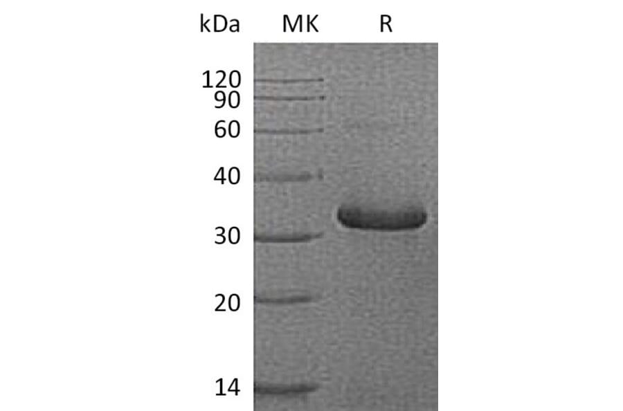 SDS-PAGE - Recombinant Human IGFBP1 Protein (6×His Tag) (A317568) - Antibodies.com