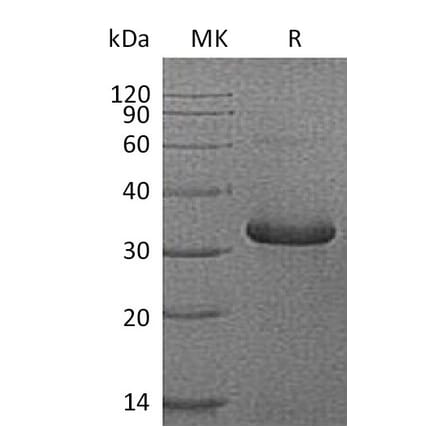 SDS-PAGE - Recombinant Human IGFBP1 Protein (6×His Tag) (A317568) - Antibodies.com