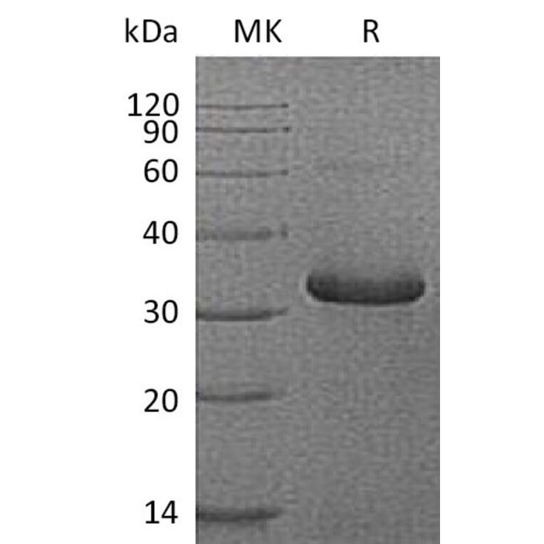 SDS-PAGE - Recombinant Human IGFBP1 Protein (6×His Tag) (A317568) - Antibodies.com