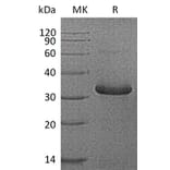 SDS-PAGE - Recombinant Human IGFBP1 Protein (6×His Tag) (A317568) - Antibodies.com