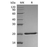 SDS-PAGE - Recombinant Human IL-28A Protein (6×His Tag) (A317569) - Antibodies.com