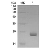 SDS-PAGE - Recombinant Human IL-28B Protein (A317570) - Antibodies.com