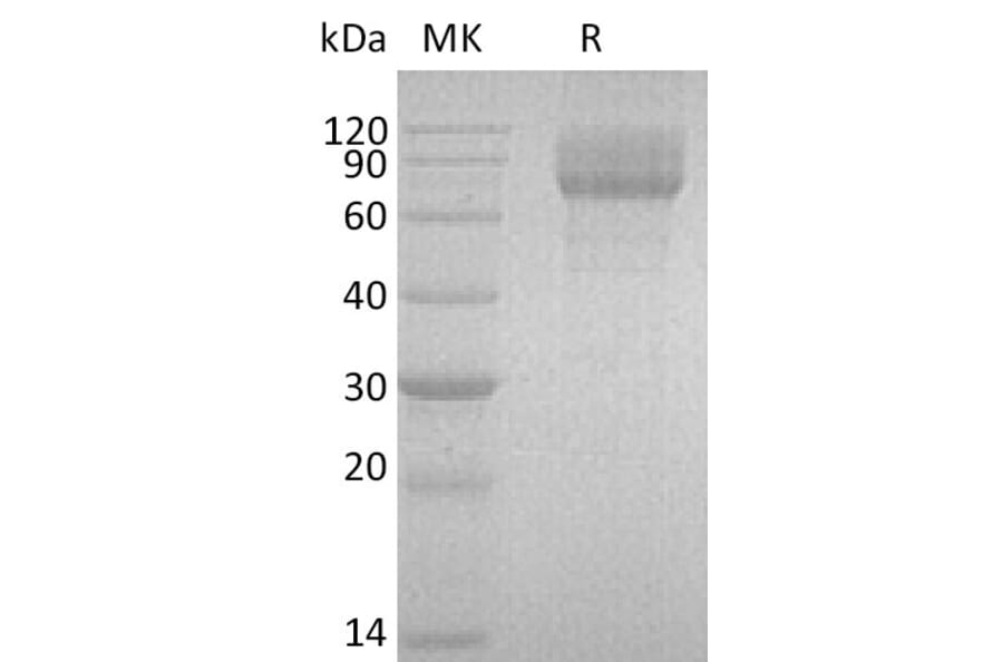 SDS-PAGE - Recombinant Human IL22 RA2/IL-22BP Protein (Fc Tag) (A317572) - Antibodies.com