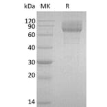 SDS-PAGE - Recombinant Human IL22 RA2/IL-22BP Protein (Fc Tag) (A317572) - Antibodies.com