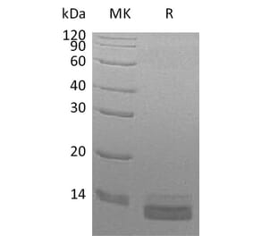 SDS-PAGE - Recombinant Human CCL14 Protein (6×His Tag) (A317573) - Antibodies.com