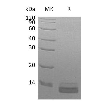 SDS-PAGE - Recombinant Human CCL14 Protein (6×His Tag) (A317573) - Antibodies.com