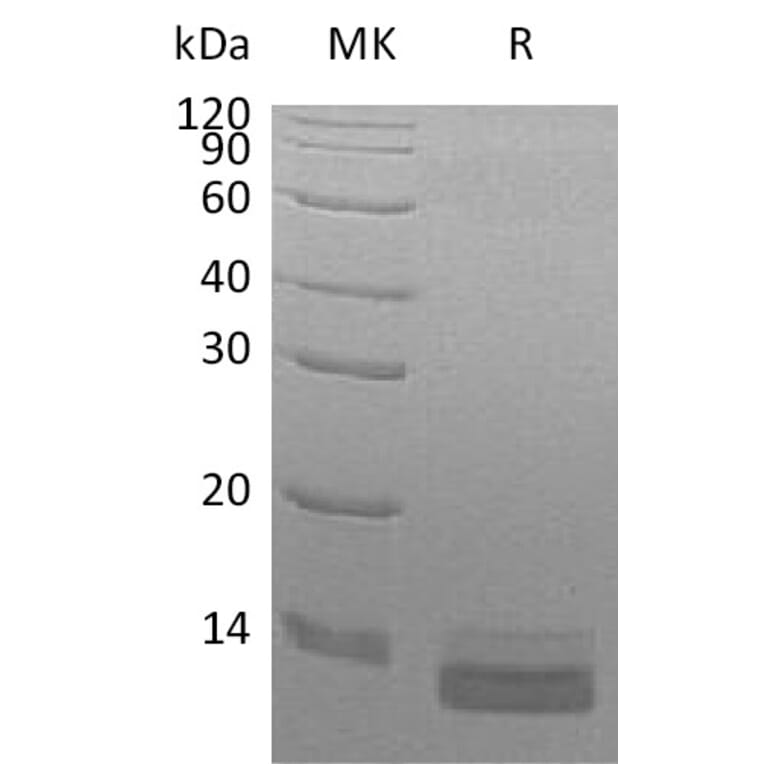 SDS-PAGE - Recombinant Human CCL14 Protein (6×His Tag) (A317573) - Antibodies.com