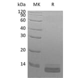 SDS-PAGE - Recombinant Human CCL14 Protein (6×His Tag) (A317573) - Antibodies.com