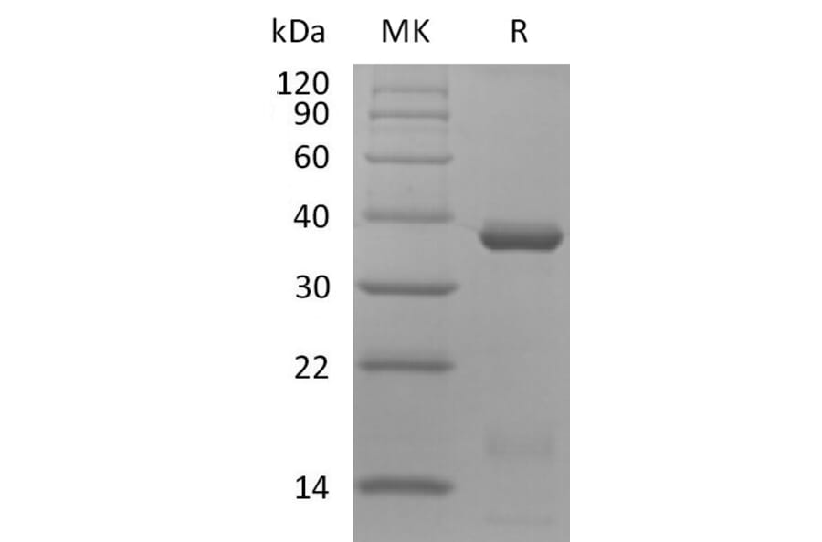 SDS-PAGE - Recombinant Human IL-15RA and IL-15 (mutated N120D) Protein (Fc Tag) Heterodimer (A317574) - Antibodies.com