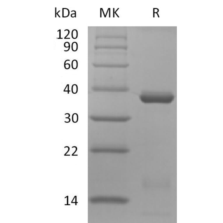 SDS-PAGE - Recombinant Human IL-15RA and IL-15 (mutated N120D) Protein (Fc Tag) Heterodimer (A317574) - Antibodies.com