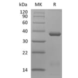 SDS-PAGE - Recombinant Human IL-15RA and IL-15 (mutated N120D) Protein (Fc Tag) Heterodimer (A317574) - Antibodies.com