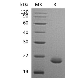 SDS-PAGE - Recombinant Human FGF10 Protein (A317576) - Antibodies.com