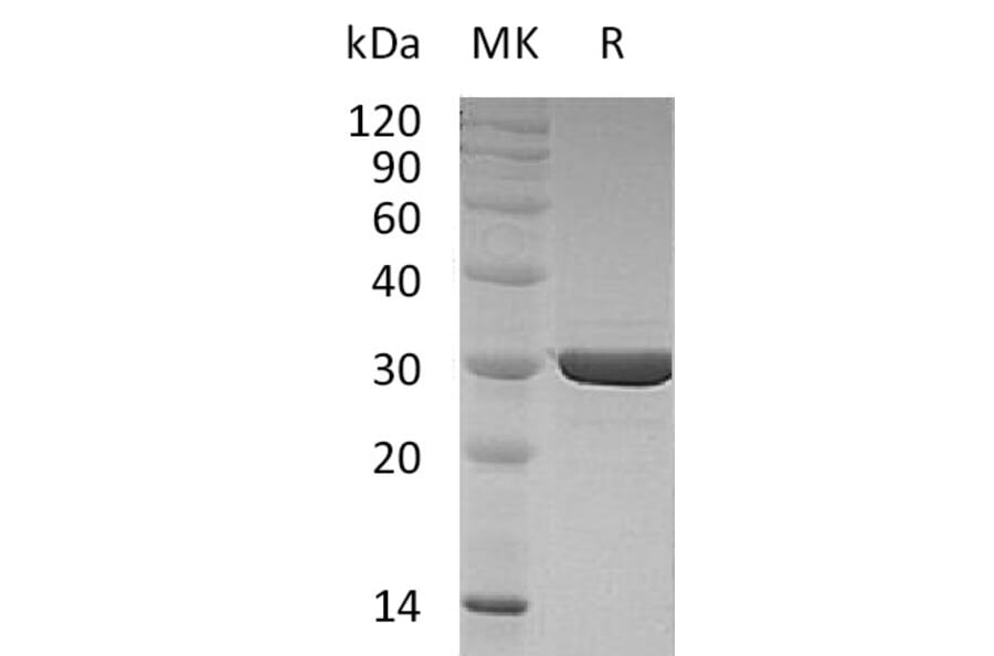 SDS-PAGE - Recombinant Human FGF8f Protein (A317577) - Antibodies.com