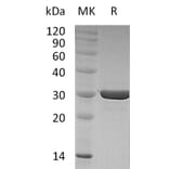 SDS-PAGE - Recombinant Human FGF8f Protein (A317577) - Antibodies.com