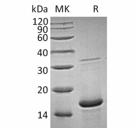 SDS-PAGE - Recombinant Human FGF1 Protein (A317578) - Antibodies.com