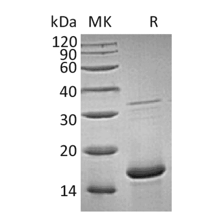 SDS-PAGE - Recombinant Human FGF1 Protein (A317578) - Antibodies.com