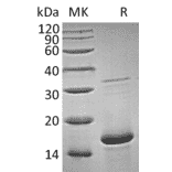 SDS-PAGE - Recombinant Human FGF1 Protein (A317578) - Antibodies.com