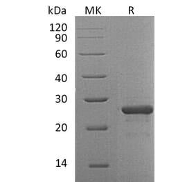 SDS-PAGE - Recombinant Human FGF19 Protein (A317579) - Antibodies.com