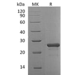 SDS-PAGE - Recombinant Human FGF19 Protein (A317579) - Antibodies.com