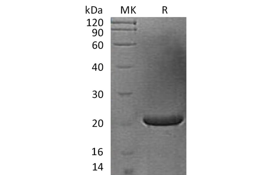 SDS-PAGE - Recombinant Human FGF17 Protein (A317580) - Antibodies.com