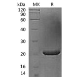 SDS-PAGE - Recombinant Human FGF17 Protein (A317580) - Antibodies.com