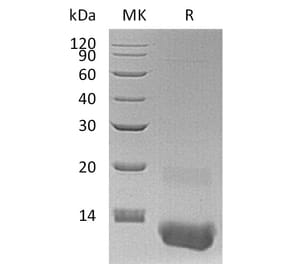 SDS-PAGE - Recombinant Human GRO gamma Protein (A317582) - Antibodies.com