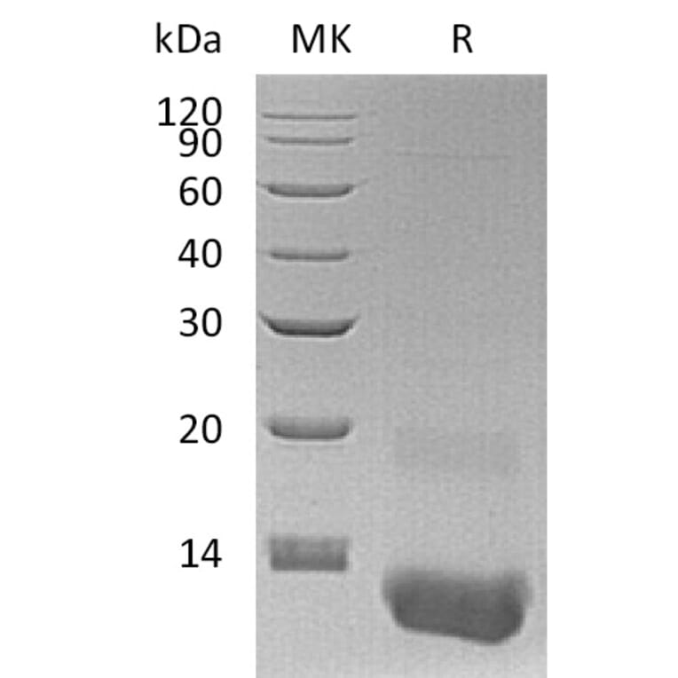 SDS-PAGE - Recombinant Human GRO gamma Protein (A317582) - Antibodies.com