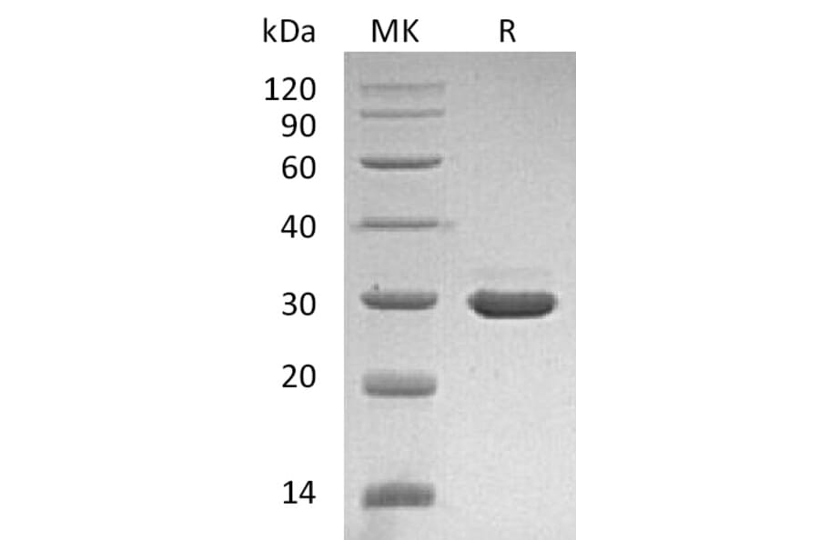 SDS-PAGE - Recombinant Human Pro-beta Nerve Growth Factor Protein (A317584) - Antibodies.com