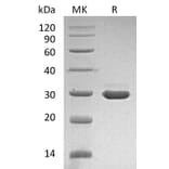 SDS-PAGE - Recombinant Human Pro-beta Nerve Growth Factor Protein (A317584) - Antibodies.com