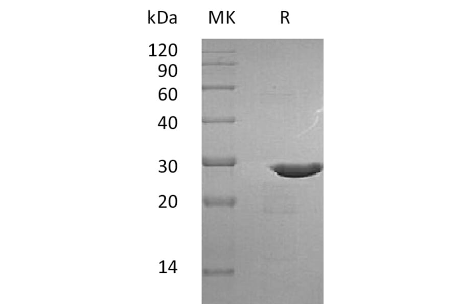 SDS-PAGE - Recombinant Human Pro-BDNF Protein (mutated R125A + R127A + R128A) (A317585) - Antibodies.com