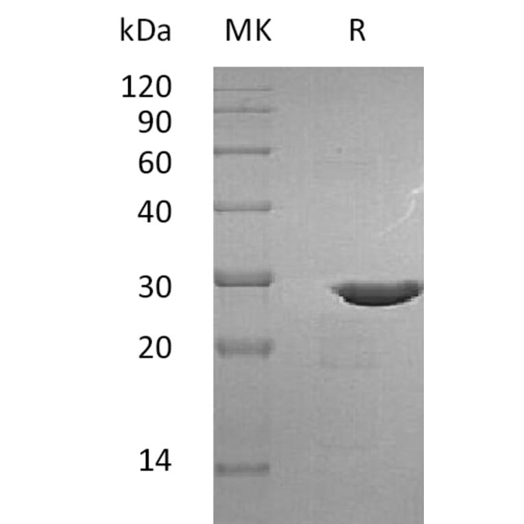 SDS-PAGE - Recombinant Human Pro-BDNF Protein (mutated R125A + R127A + R128A) (A317585) - Antibodies.com