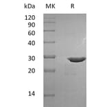 SDS-PAGE - Recombinant Human Pro-BDNF Protein (mutated R125A + R127A + R128A) (A317585) - Antibodies.com