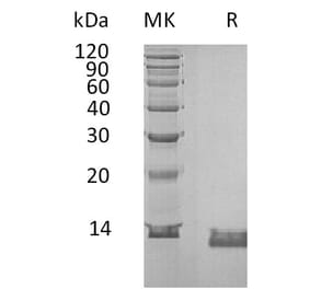 SDS-PAGE - Recombinant Human IL-8 Protein (6×His Tag) (A317586) - Antibodies.com