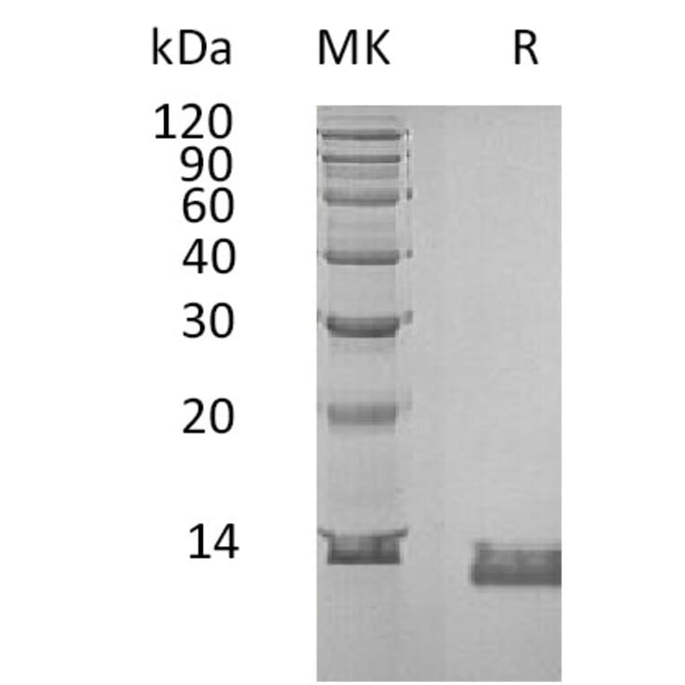 SDS-PAGE - Recombinant Human IL-8 Protein (6×His Tag) (A317586) - Antibodies.com