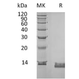 SDS-PAGE - Recombinant Human IL-8 Protein (6×His Tag) (A317586) - Antibodies.com
